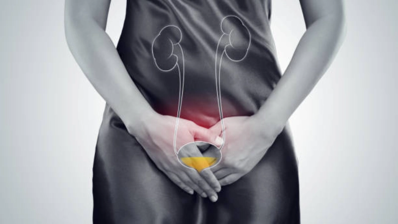Kegel exercise