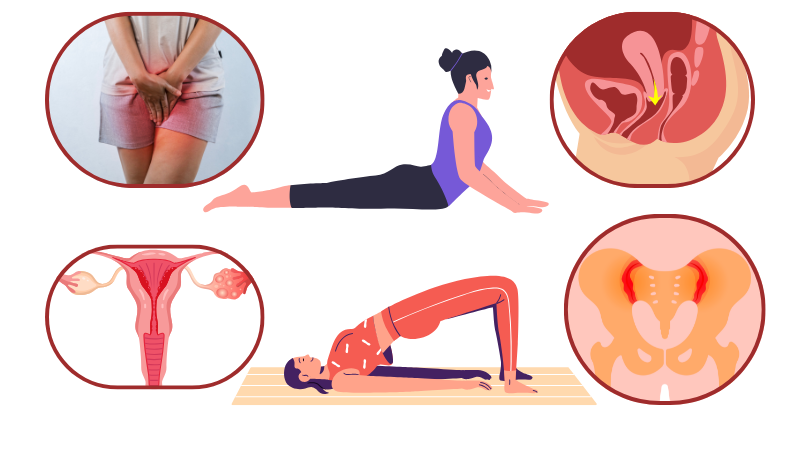 pelvic floor, Kegel exercise